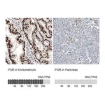 Atlas Antibodies Anti-PGR Antibody