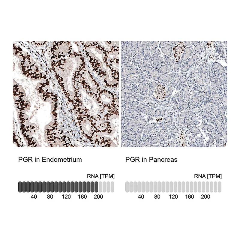 Atlas Antibodies Anti-PGR Antibody