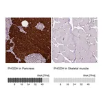 Atlas Antibodies Anti-PHGDH Antibody