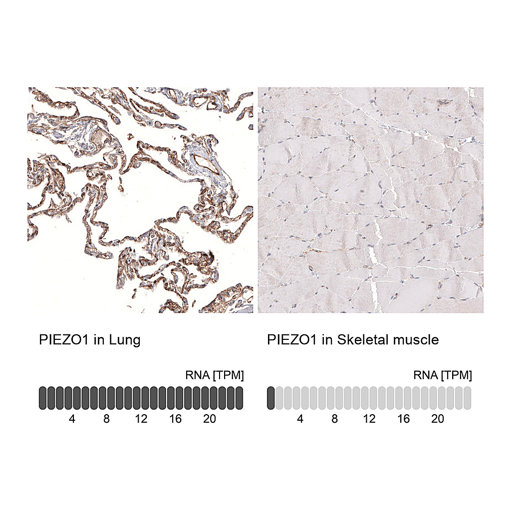 Atlas Antibodies Anti-PIEZO1 Antibody