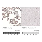Atlas Antibodies Anti-PIEZO1 Antibody