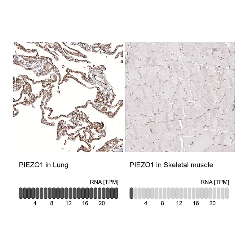 Atlas Antibodies Anti-PIEZO1 Antibody