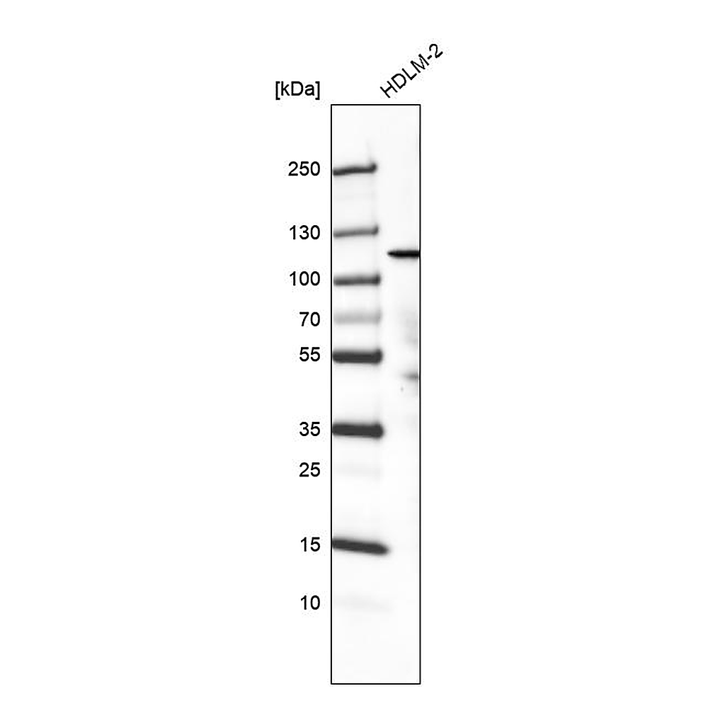 Atlas Antibodies Anti-PIK3CA Antibody