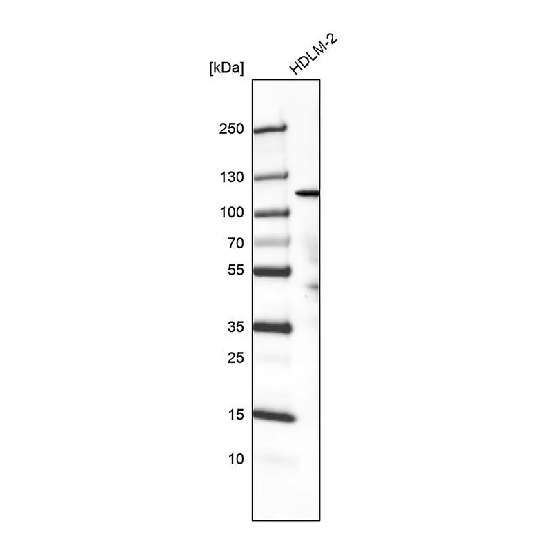 Atlas Antibodies Anti-PIK3CA Antibody