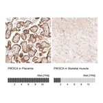 Atlas Antibodies Anti-PIK3CA Antibody