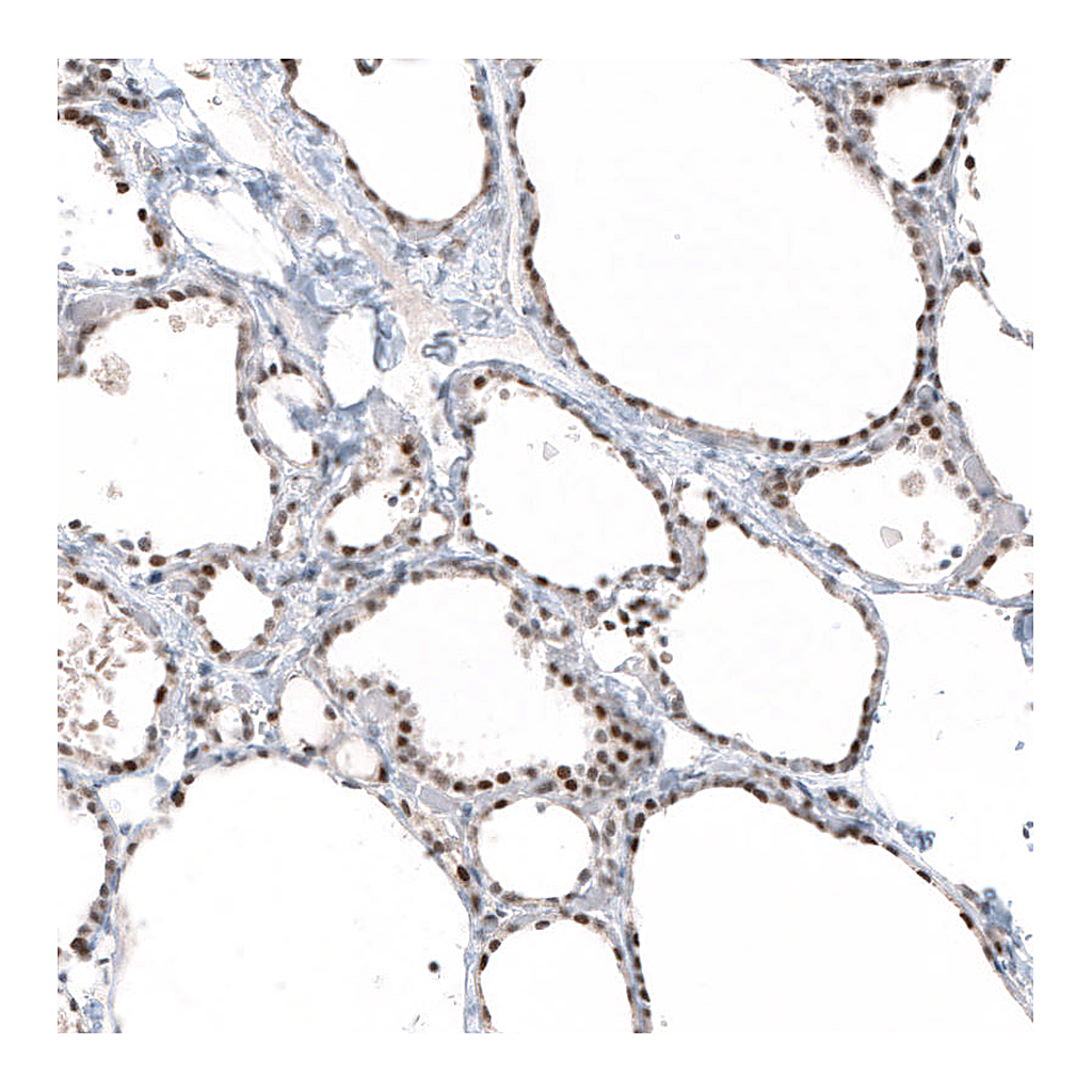 Atlas Antibodies Anti-PIK3CB Antibody