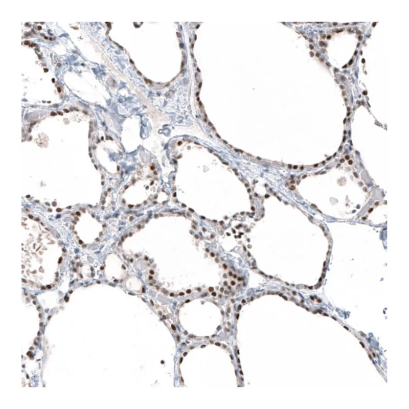 Atlas Antibodies Anti-PIK3CB Antibody