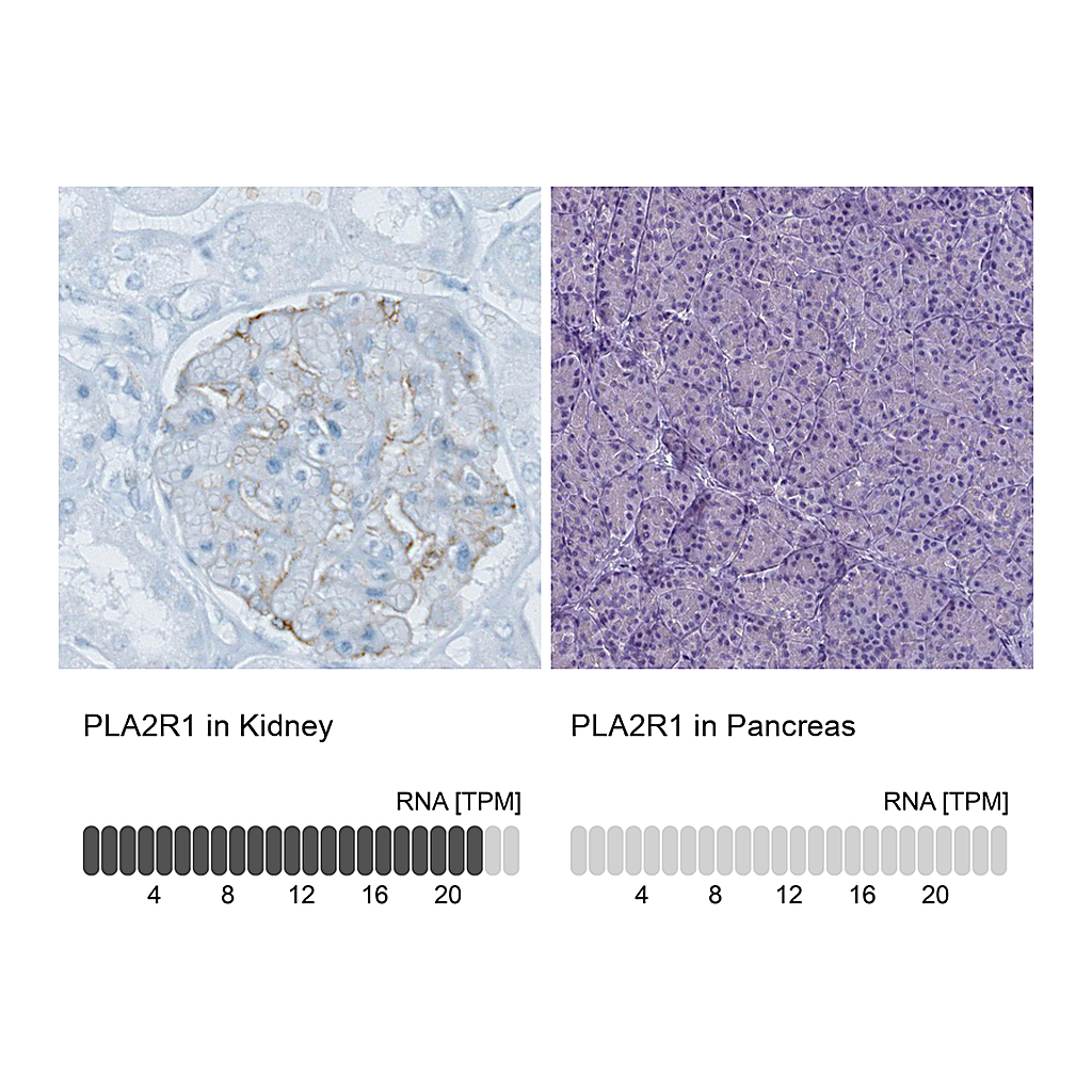 Atlas Antibodies Anti-PLA2R1 Antibody