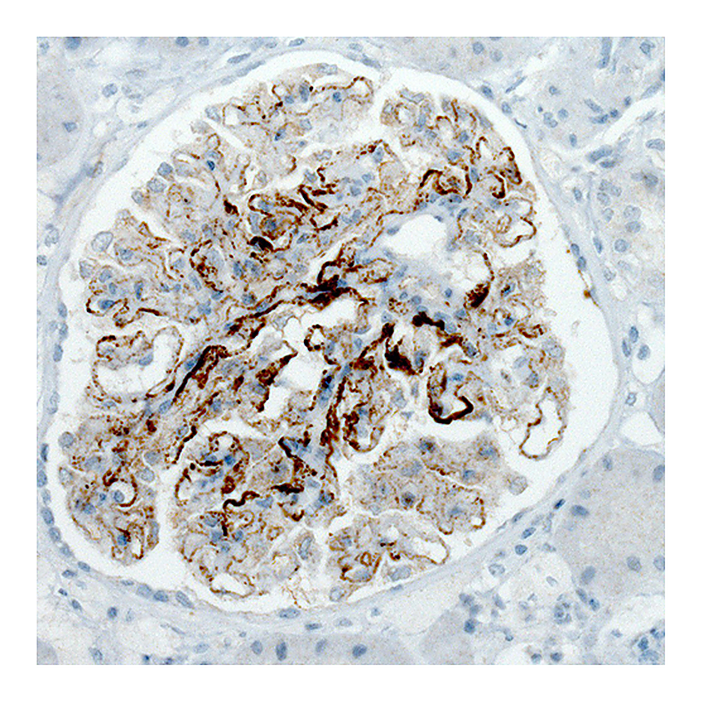 Atlas Antibodies Anti-PLA2R1 Antibody