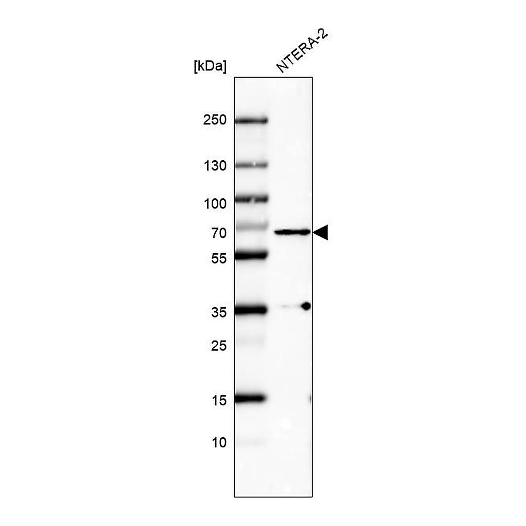 Atlas Antibodies Anti-PLK1 Antibody