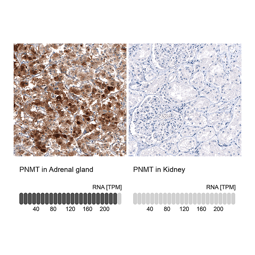 Atlas Antibodies Anti-PNMT Antibody