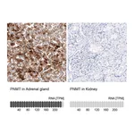 Atlas Antibodies Anti-PNMT Antibody