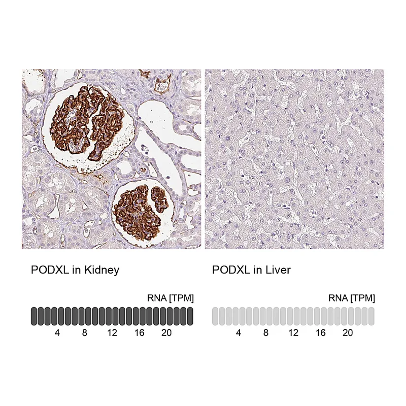 Atlas Antibodies Anti-PODXL Antibody