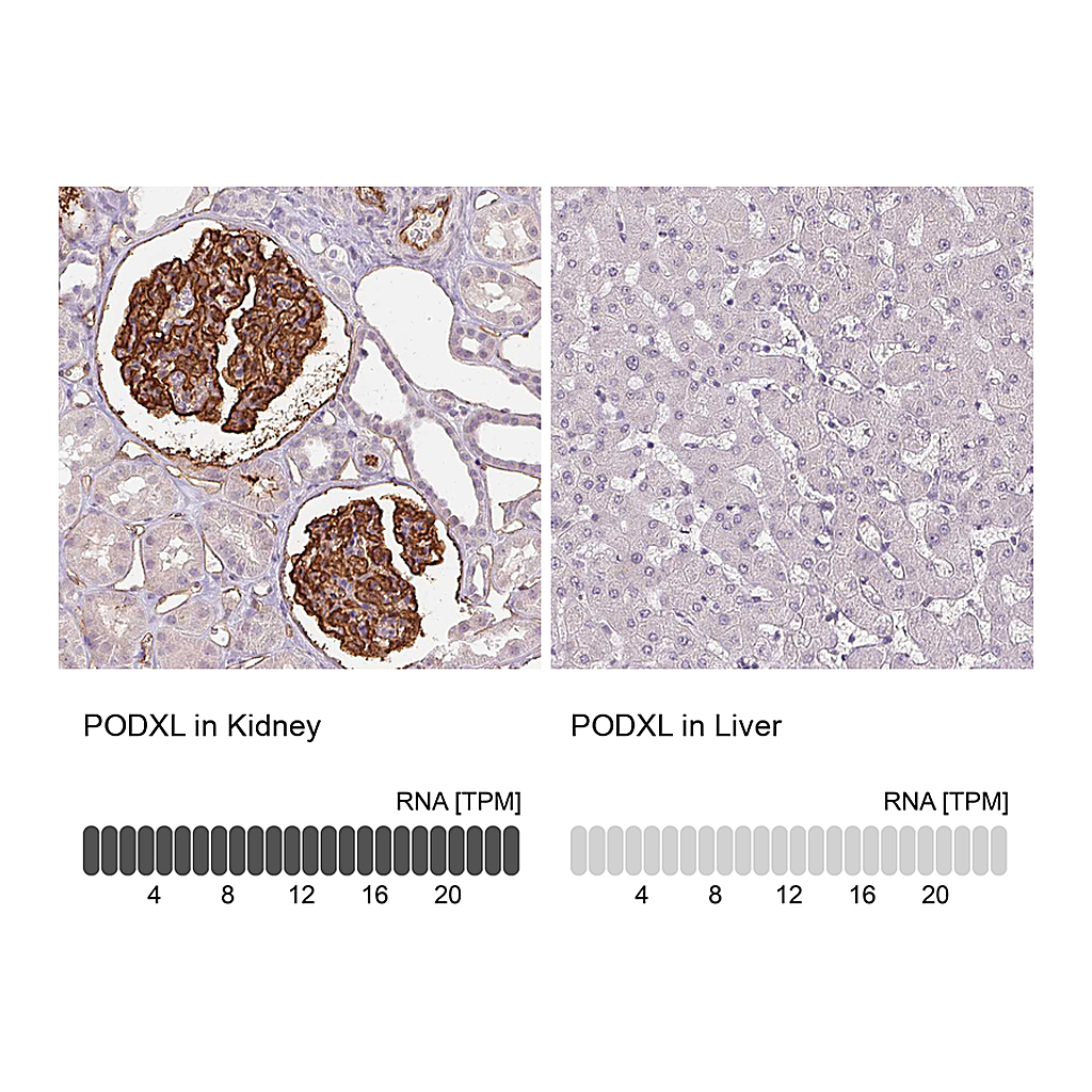 Atlas Antibodies Anti-PODXL Antibody