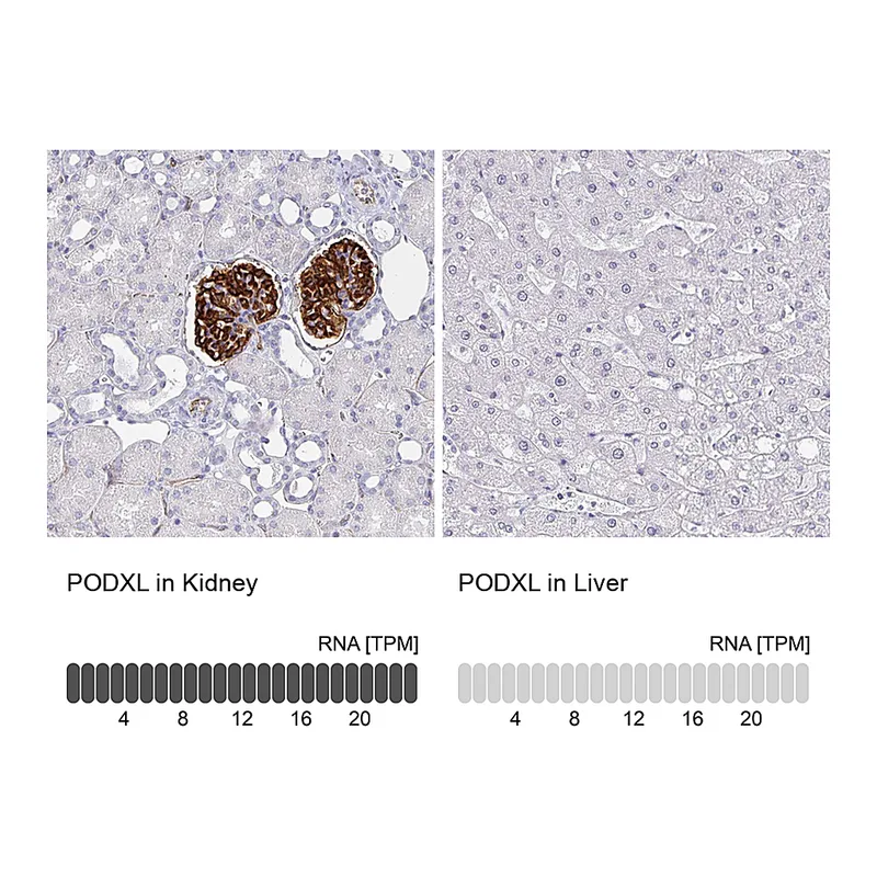 Atlas Antibodies Anti-PODXL Antibody