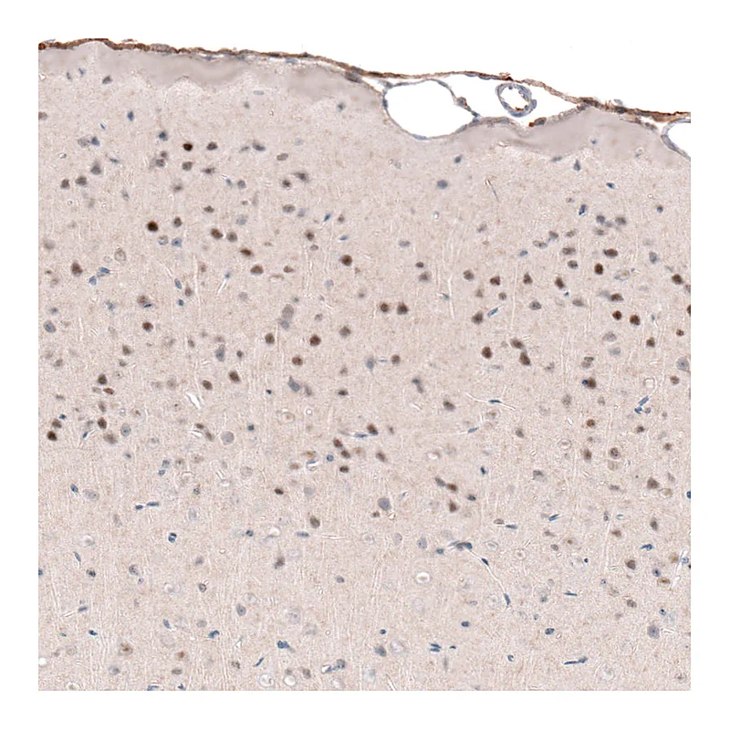 Atlas Antibodies Anti-POU3F2 Antibody