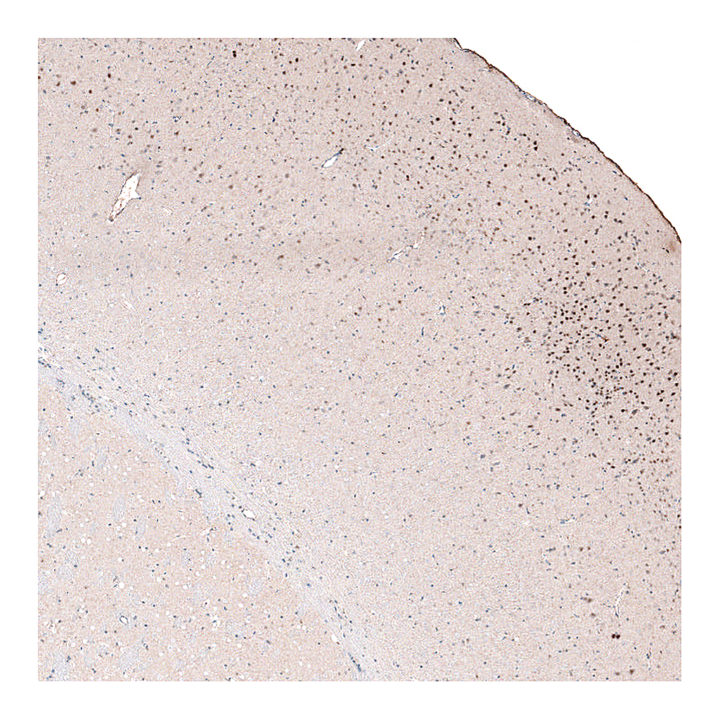 Atlas Antibodies Anti-POU3F2 Antibody