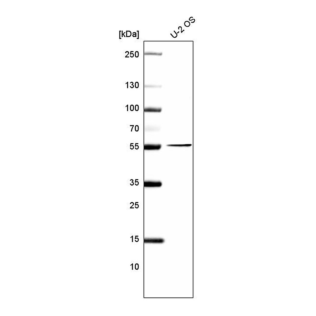 Atlas Antibodies Anti-PRAME Antibody