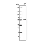 Atlas Antibodies Anti-PRAME Antibody