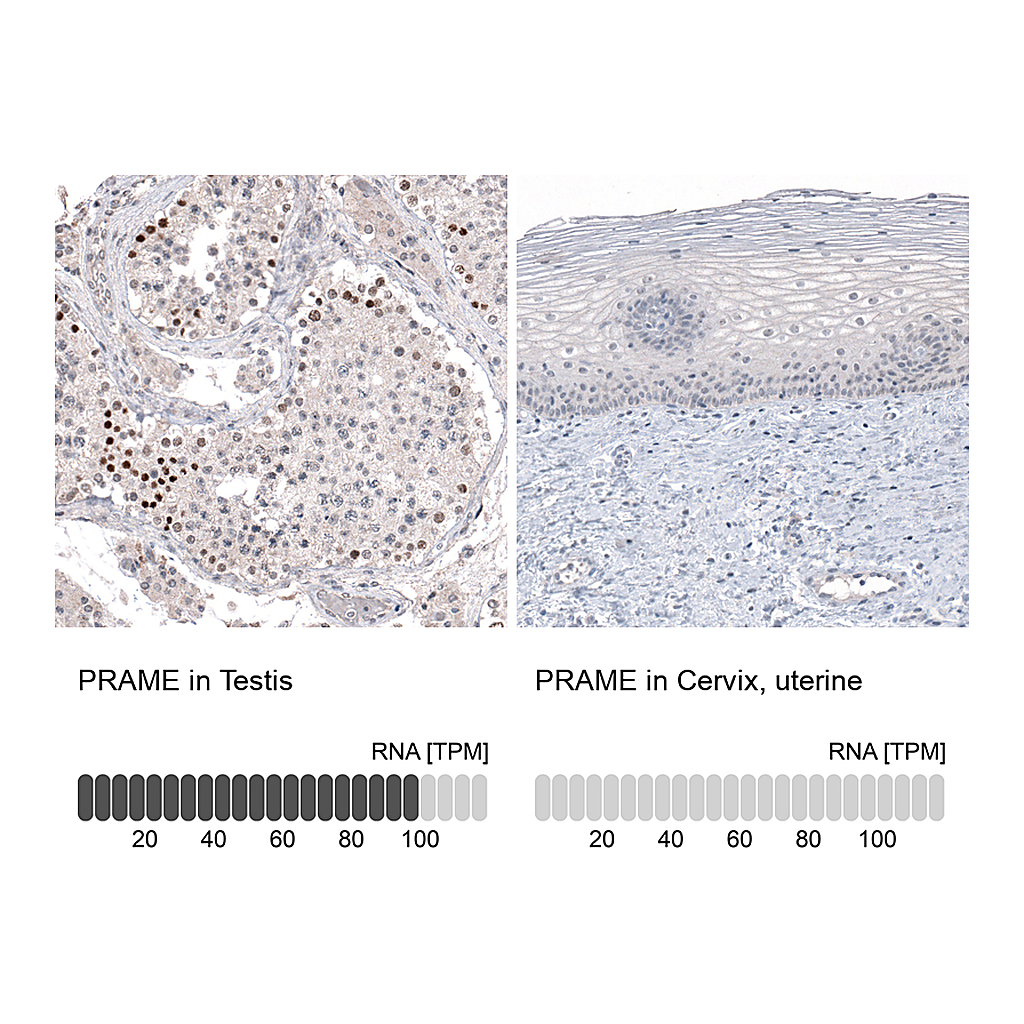 Atlas Antibodies Anti-PRAME Antibody