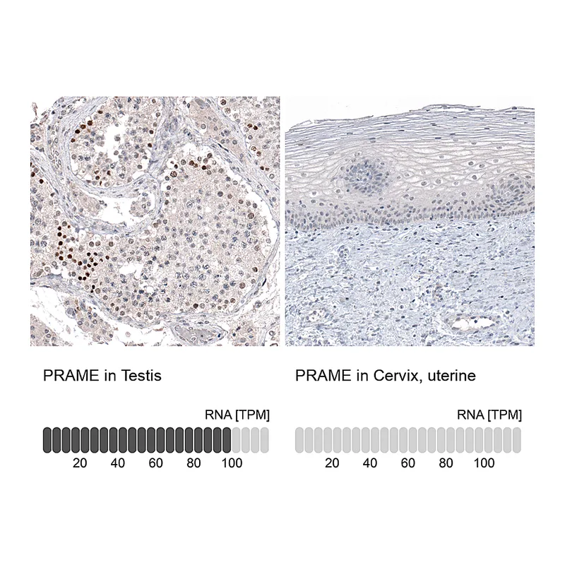 Atlas Antibodies Anti-PRAME Antibody