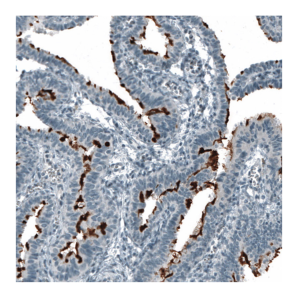 Atlas Antibodies Anti-PROM1 Antibody