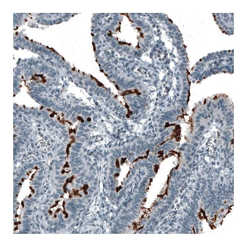 Atlas Antibodies Anti-PROM1 Antibody