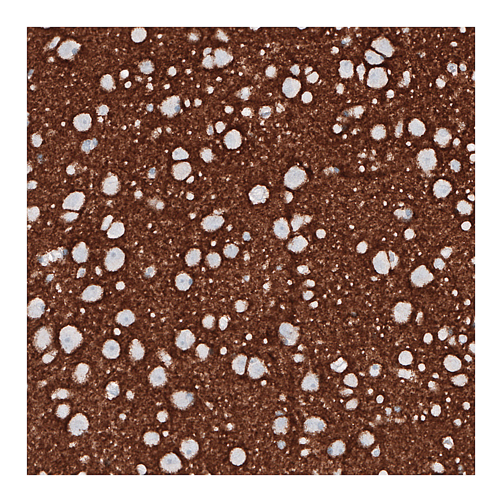 Atlas Antibodies Anti-PRRT2 Antibody