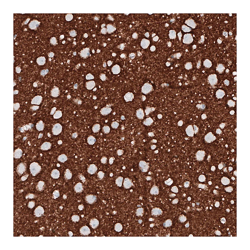 Atlas Antibodies Anti-PRRT2 Antibody