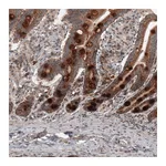 Atlas Antibodies Anti-RBCK1 Antibody