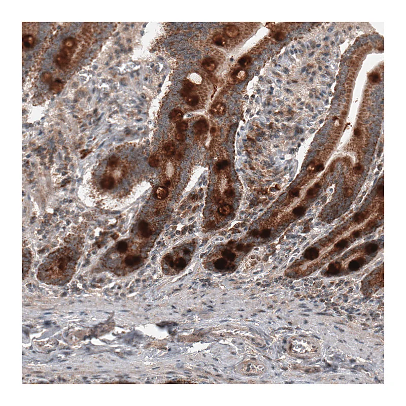 Atlas Antibodies Anti-RBCK1 Antibody