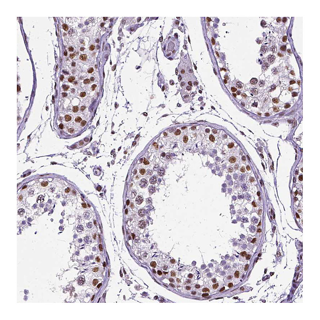 Atlas Antibodies Anti-REST Antibody
