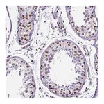 Atlas Antibodies Anti-REST Antibody