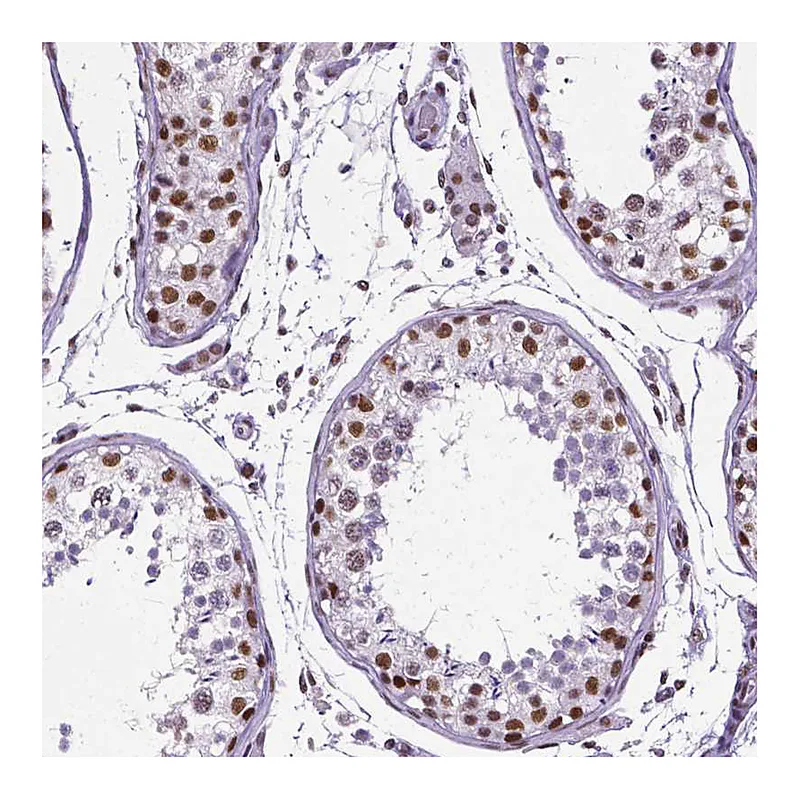 Atlas Antibodies Anti-REST Antibody