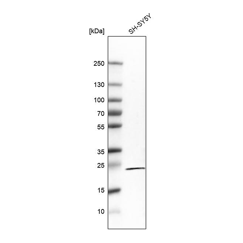 Atlas Antibodies Anti-RGS5 Antibody