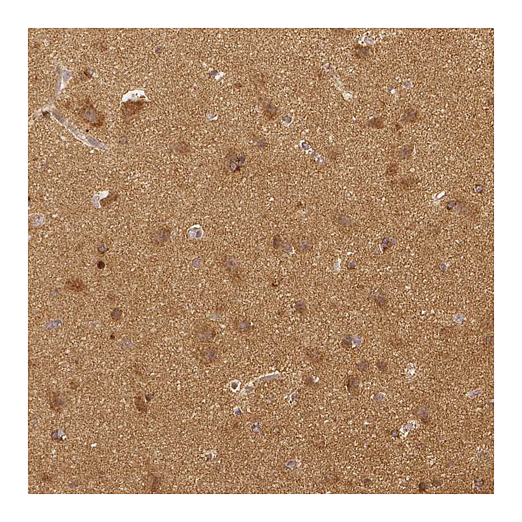 Atlas Antibodies Anti-RHOT1 Antibody