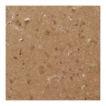 Atlas Antibodies Anti-RHOT1 Antibody