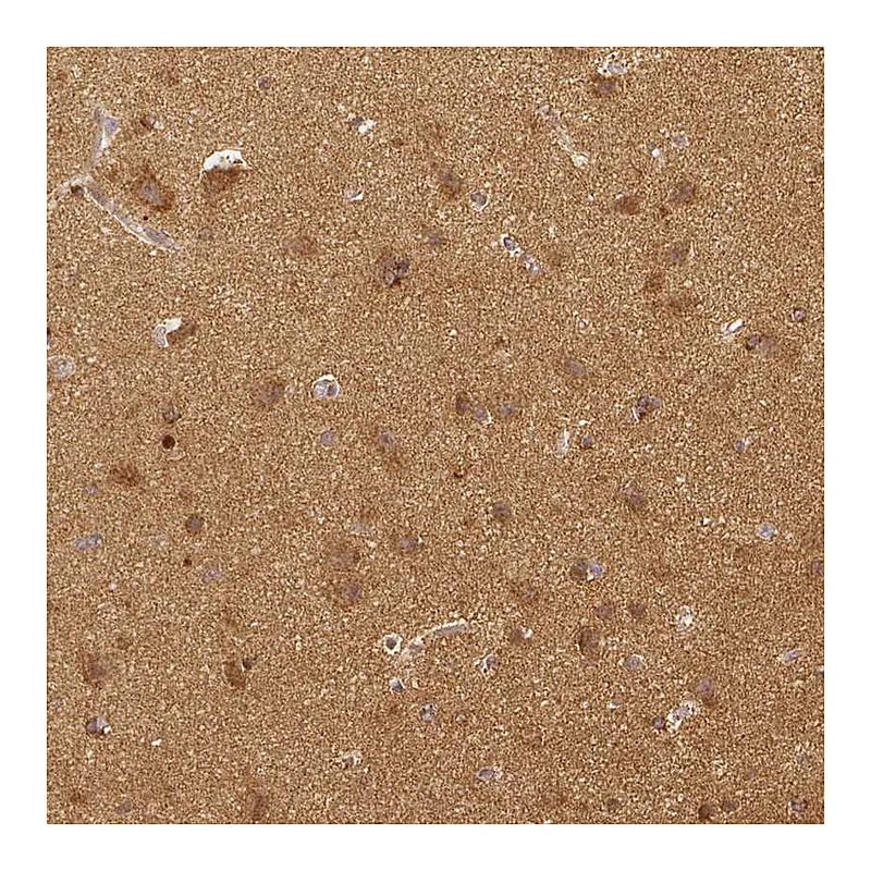 Atlas Antibodies Anti-RHOT1 Antibody