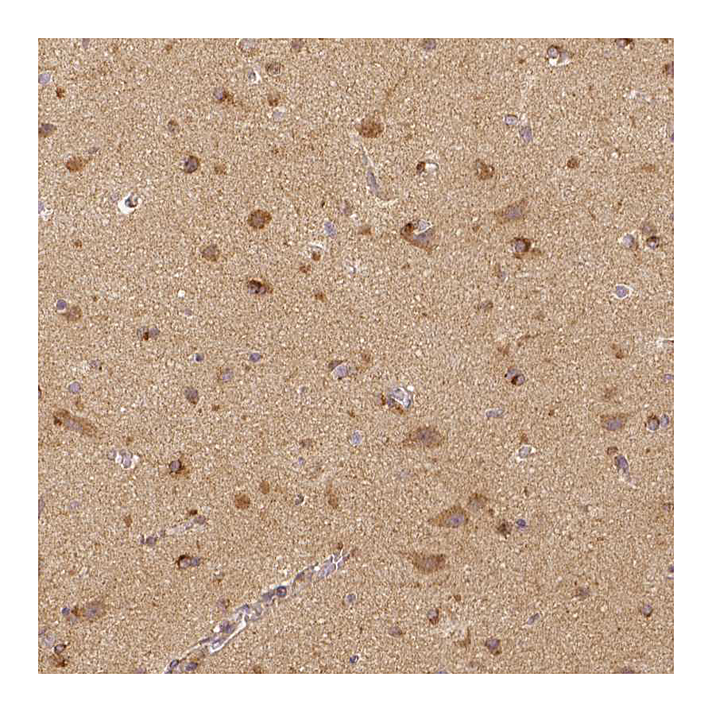 Atlas Antibodies Anti-RHOT1 Antibody