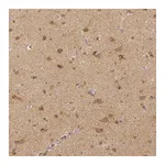 Atlas Antibodies Anti-RHOT1 Antibody