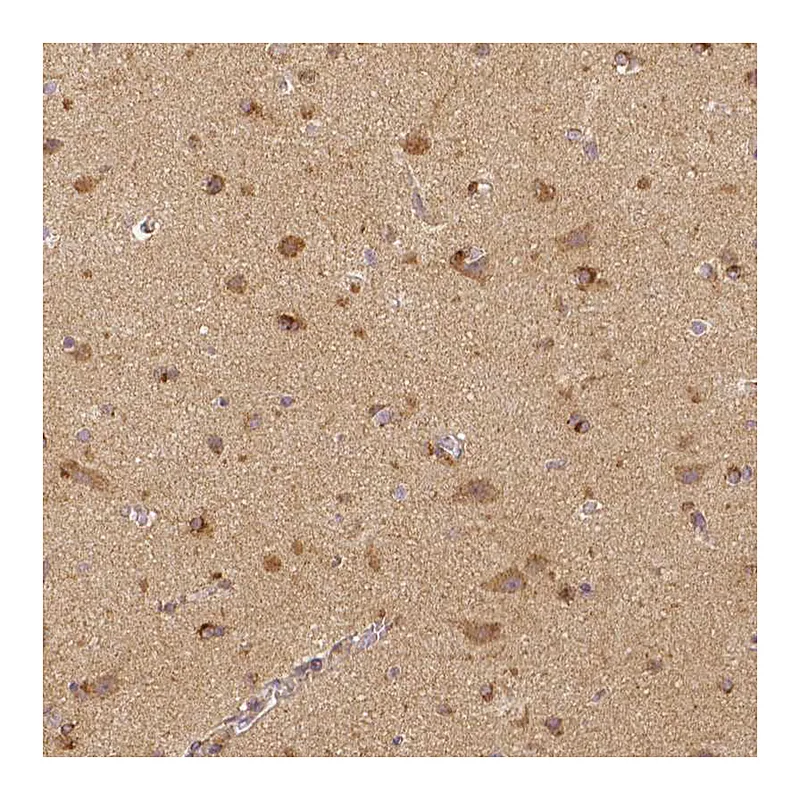 Atlas Antibodies Anti-RHOT1 Antibody
