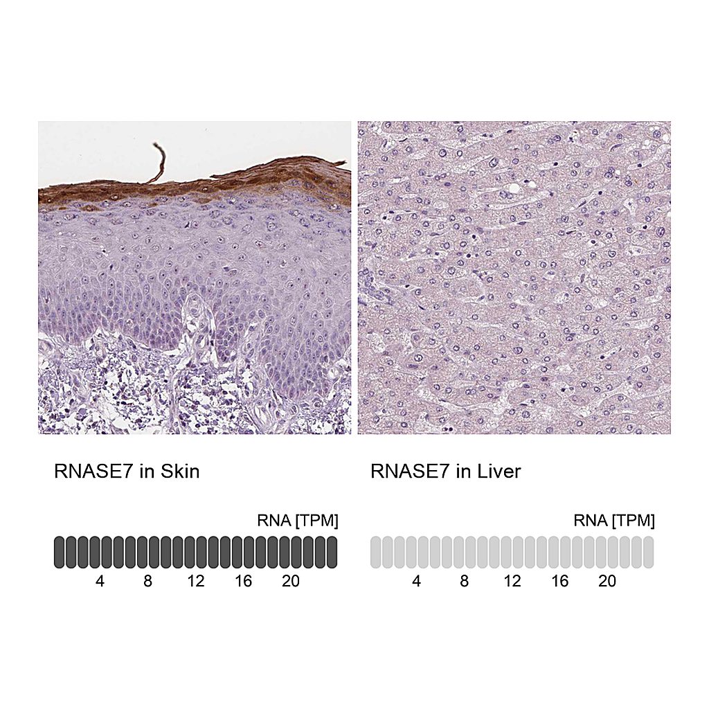 Atlas Antibodies Anti-RNASE7 Antibody