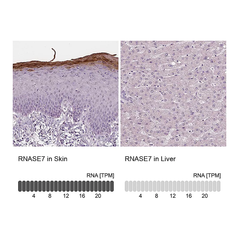 Atlas Antibodies Anti-RNASE7 Antibody