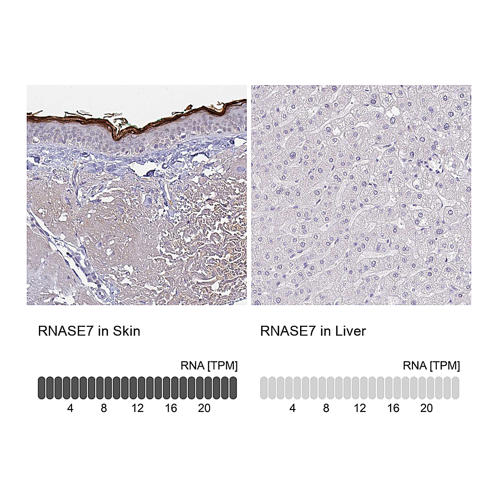 Atlas Antibodies Anti-RNASE7 Antibody