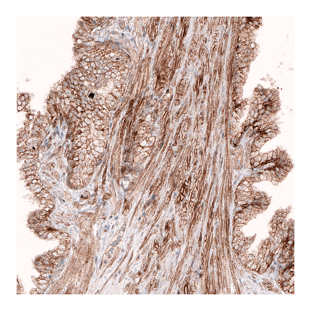 Atlas Antibodies Anti-ROR2 Antibody