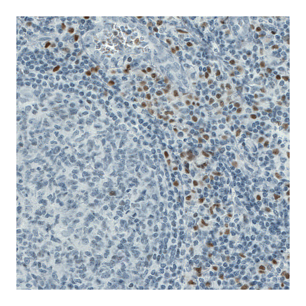 Atlas Antibodies Anti-RUNX2 Antibody