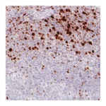 Atlas Antibodies Anti-RUNX2 Antibody