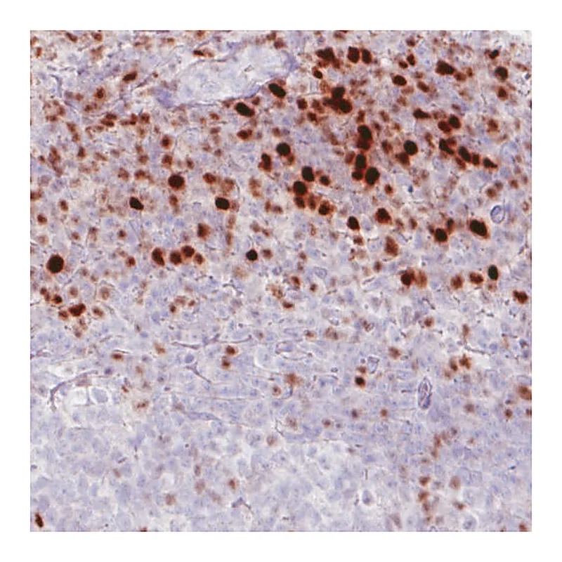 Atlas Antibodies Anti-RUNX2 Antibody