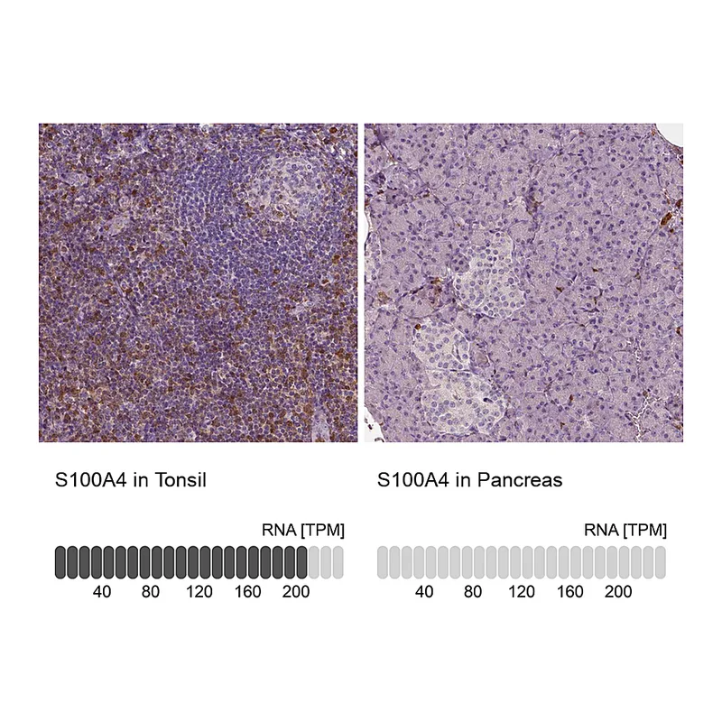 Atlas Antibodies Anti-S100A4 Antibody