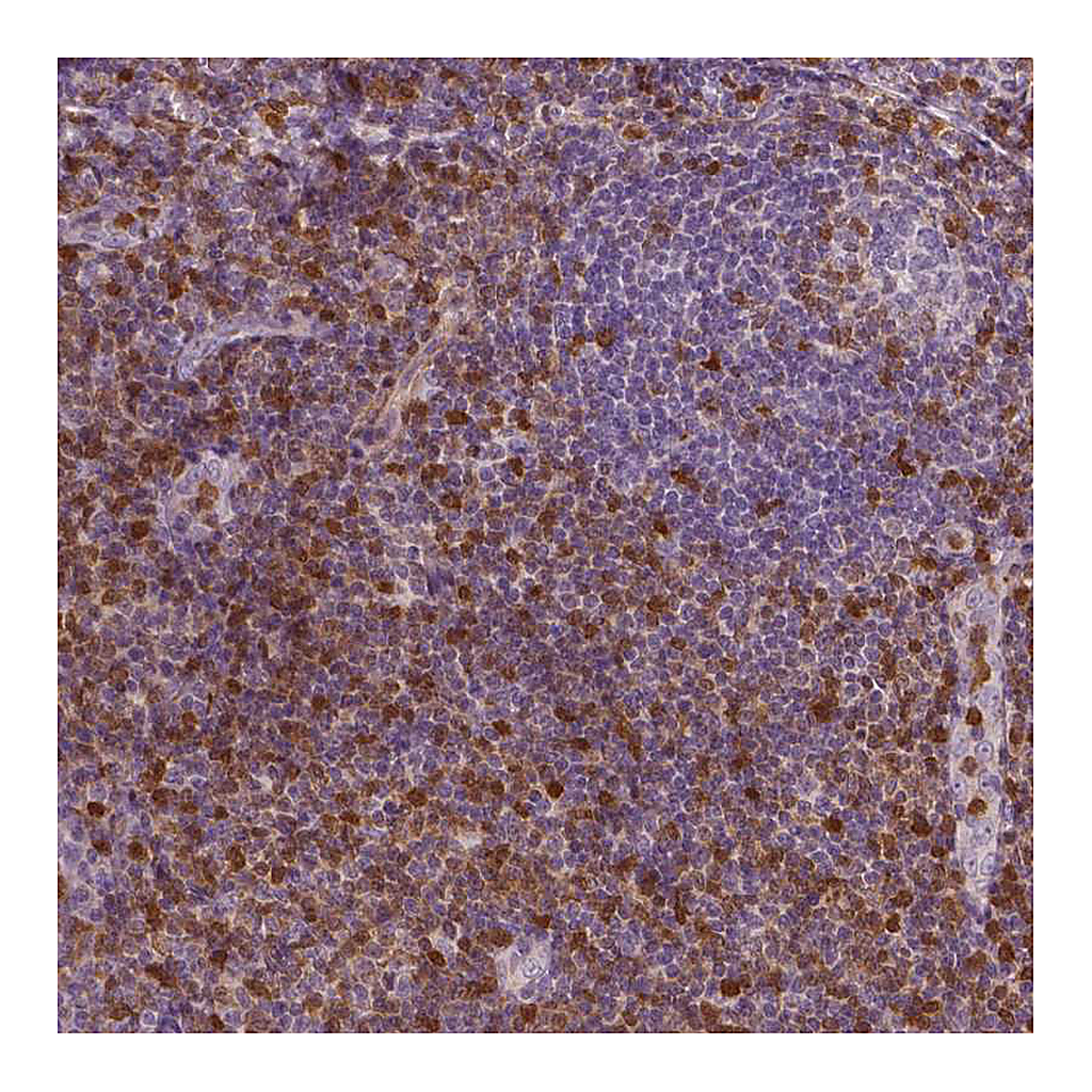 Atlas Antibodies Anti-S100A4 Antibody